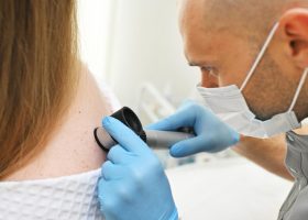 Cancer de la peau