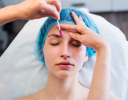 Qu’est-ce que le xanthélasma ? Guide complet pour les patients