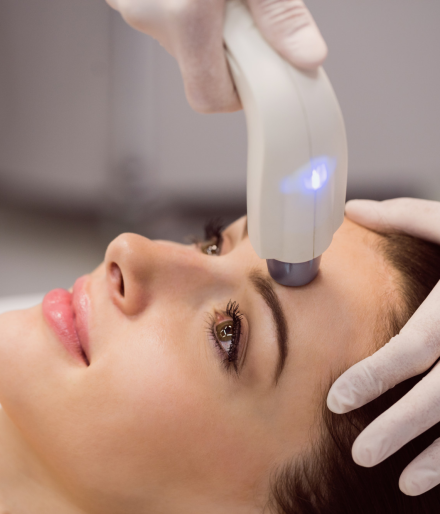 Peeling chimique ou laser pour l&rsquo;hyperpigmentation : quelle option est la plus sécuritaire ?