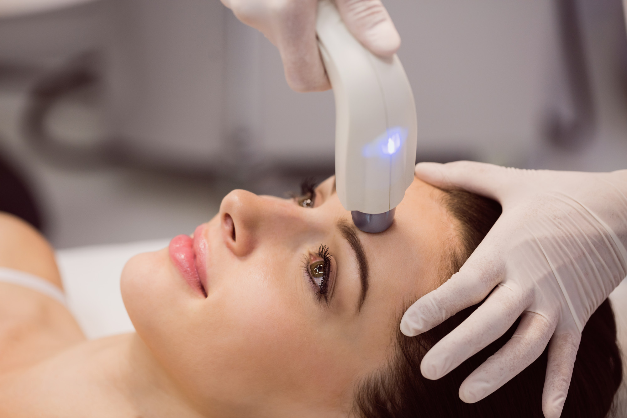 Chemical Peels vs. Laser for Hyperpigmentation – Which Is Safer?