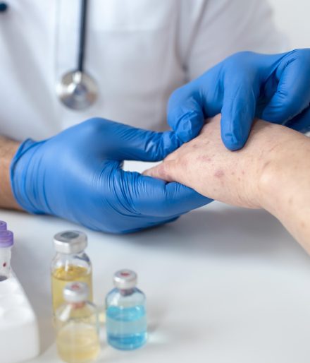 Qu’est-ce qu’une urgence dermatologique et que faire lorsqu’on se trouve dans une telle situation ?