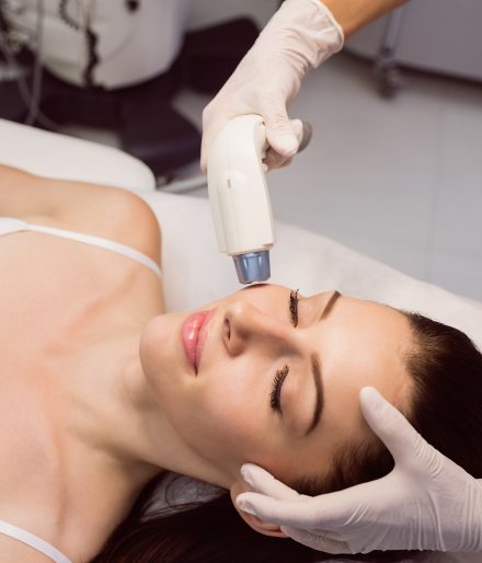 Resurfaçage au laser c. thérapie PRP : choisir le meilleur traitement des cicatrices d&rsquo;acné à Montréal