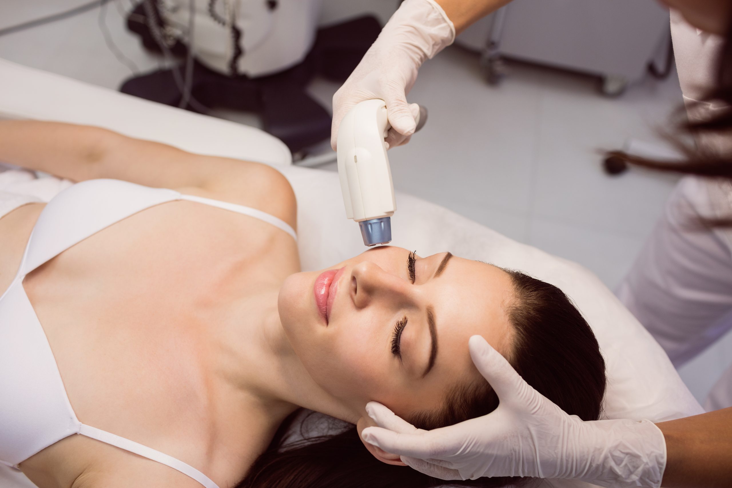 Resurfaçage au laser c. thérapie PRP : choisir le meilleur traitement des cicatrices d&rsquo;acné à Montréal